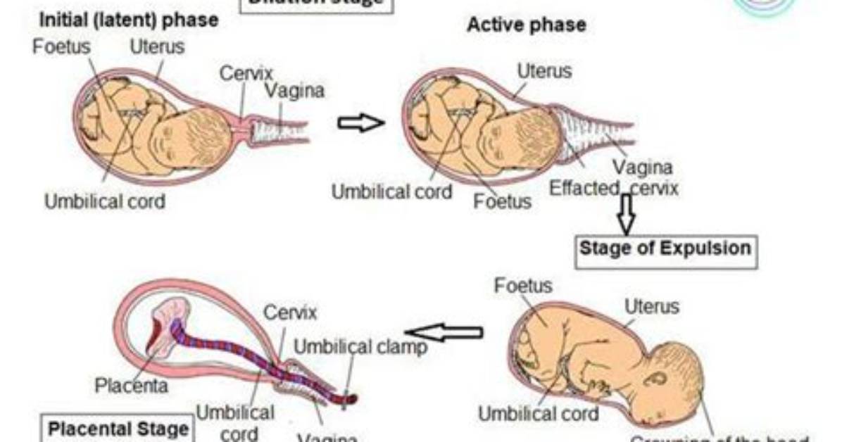 When Does Parturition Begin?