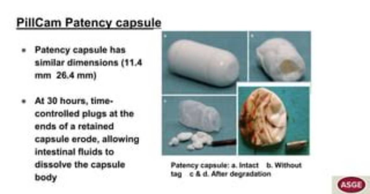 When Does Patency Capsule Dissolve?