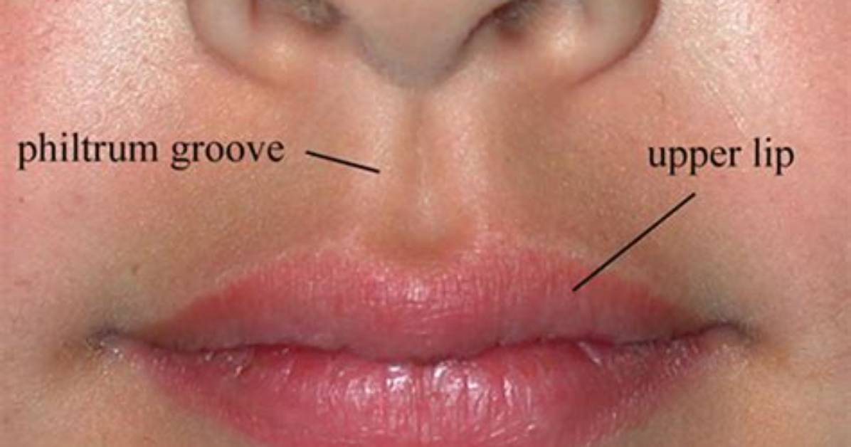 When Does Philtrum Develop?