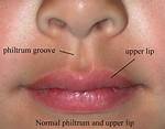 When Does Philtrum Develop?
