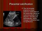 When Does Placenta Start Calcifying?
