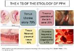 When Does Pph Occur?