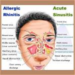 When Does Rhinitis Go Away?