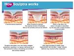 When Does Sculptra Start Working?