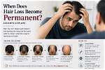 When Does Secondment Become Permanent?