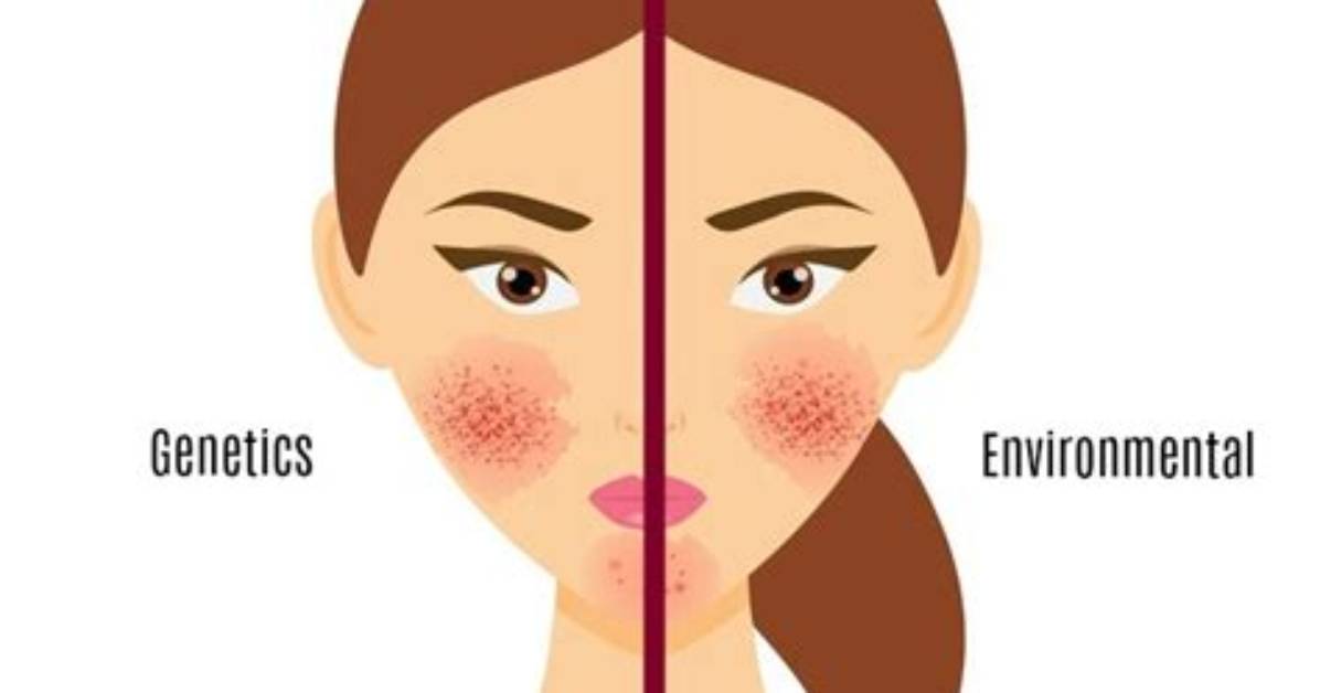 When Does Sensitization Occur?