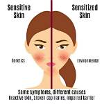 When Does Sensitization Occur?