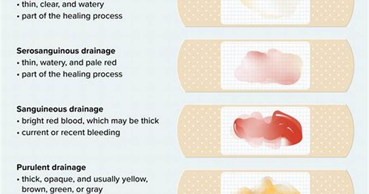 When Does Serous Drainage Stop?