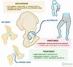 When Does the Acetabulum Ossify?