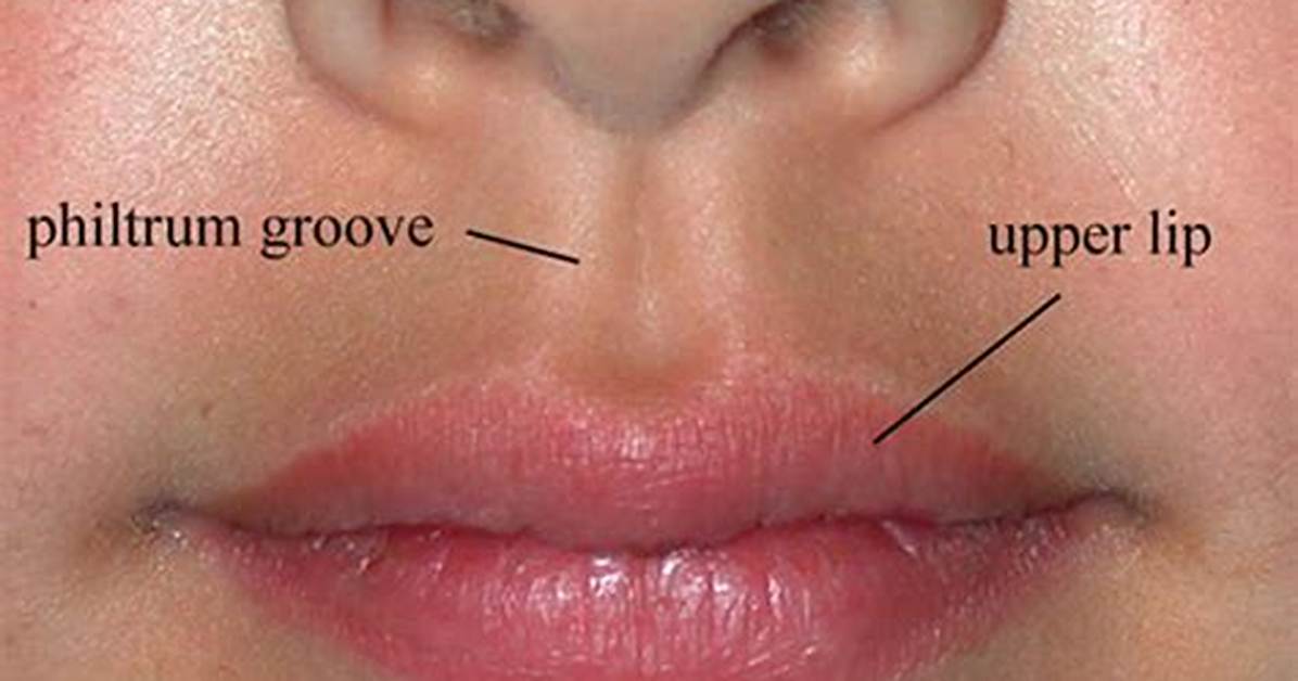 When Does the Philtrum Develop?