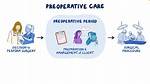 When Does the Preoperative Phase Begin?