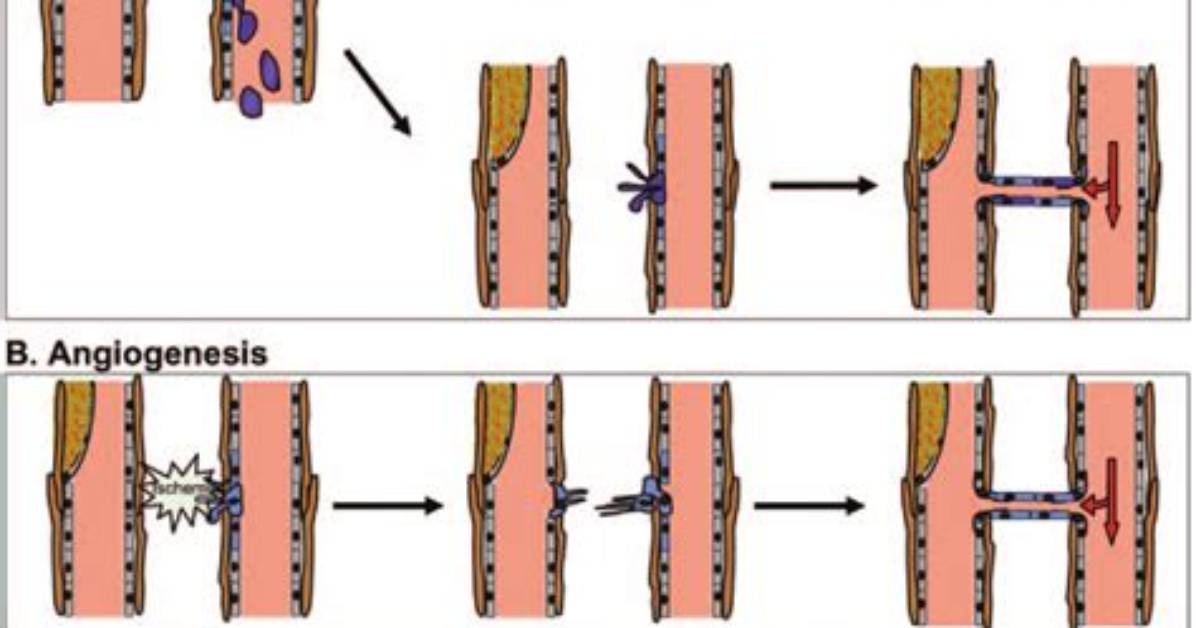 When Does Vasculogenesis Occur?