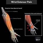 When Extending the Forearm?
