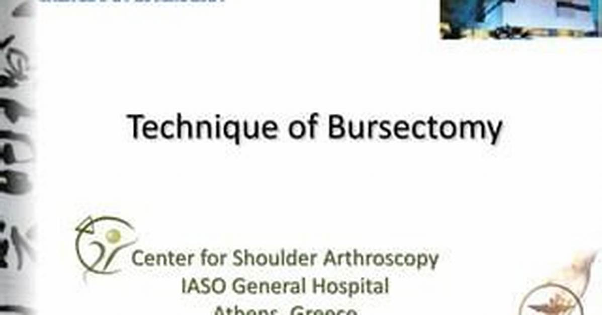 When Is a Bursectomy Necessary?
