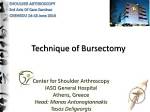 When Is a Bursectomy Necessary?