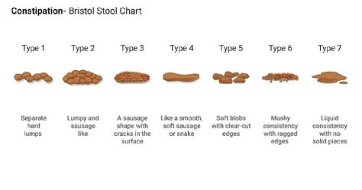 When Is Constipation Worrisome?