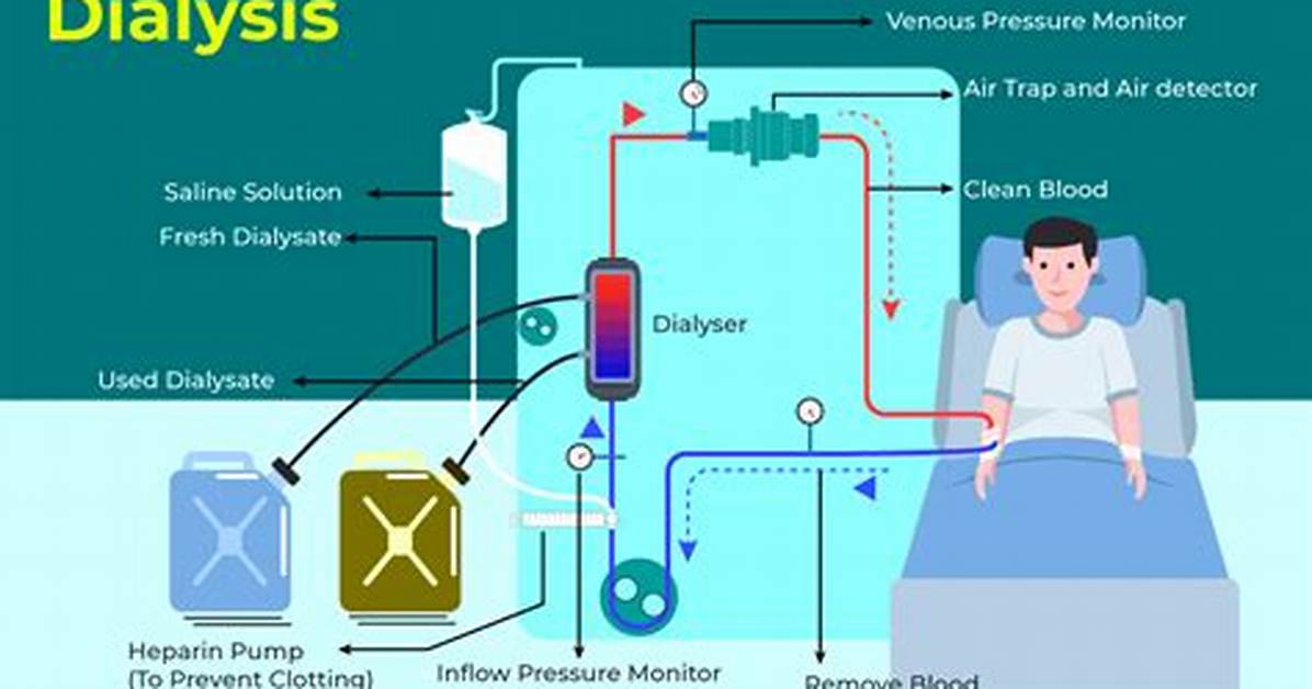 When Is Dialysis Advised?