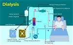 When Is Dialysis Advised?