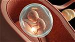 When Is Early Gestation?