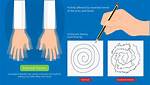 When Is Essential Tremor?