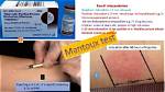 When Is Mantoux Test Read?