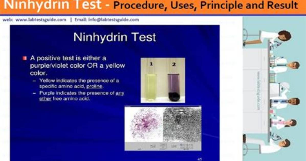 When Is Ninhydrin Used?