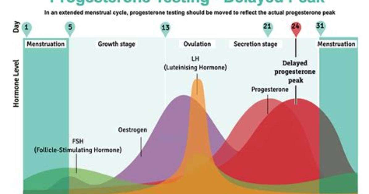 When Progesterone Test Done?
