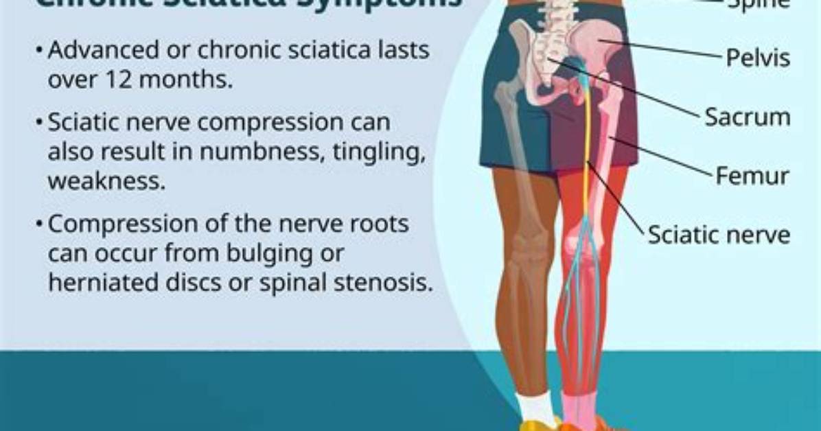 When Sciatica Is Dangerous?