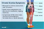 When Sciatica Is Dangerous?
