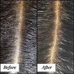 When Scratching Scalp White Stuff?