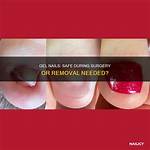When Should Nails Be Removed