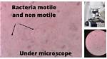When Something Is Motile?