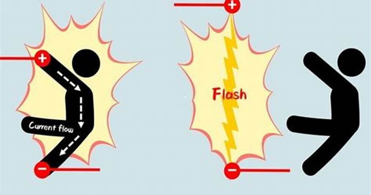 When Sustaining Electrical Burn?