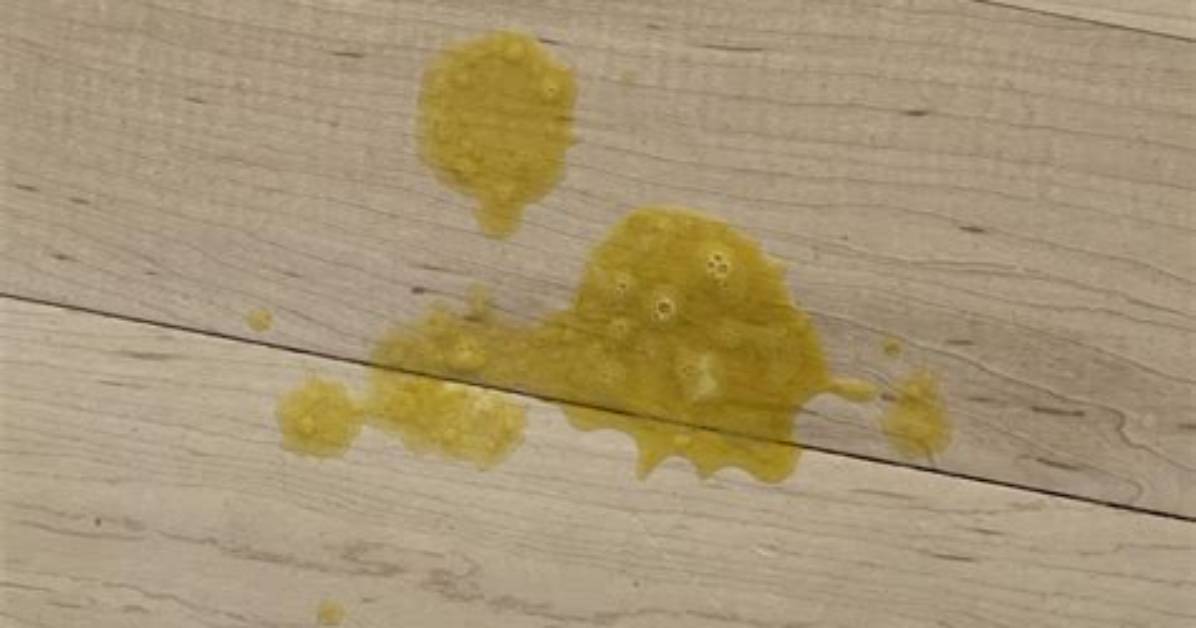 When Throwing up Yellow Stuff?