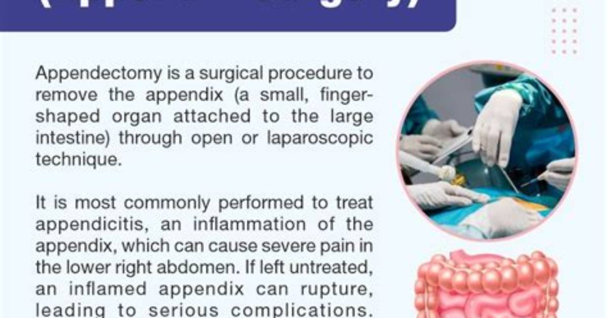 When to Do Appendix Surgery?