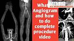 When to Do Arteriogram?