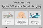 When to Do Herniotomy?