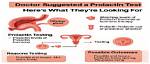 When to Do Prolactin Test?
