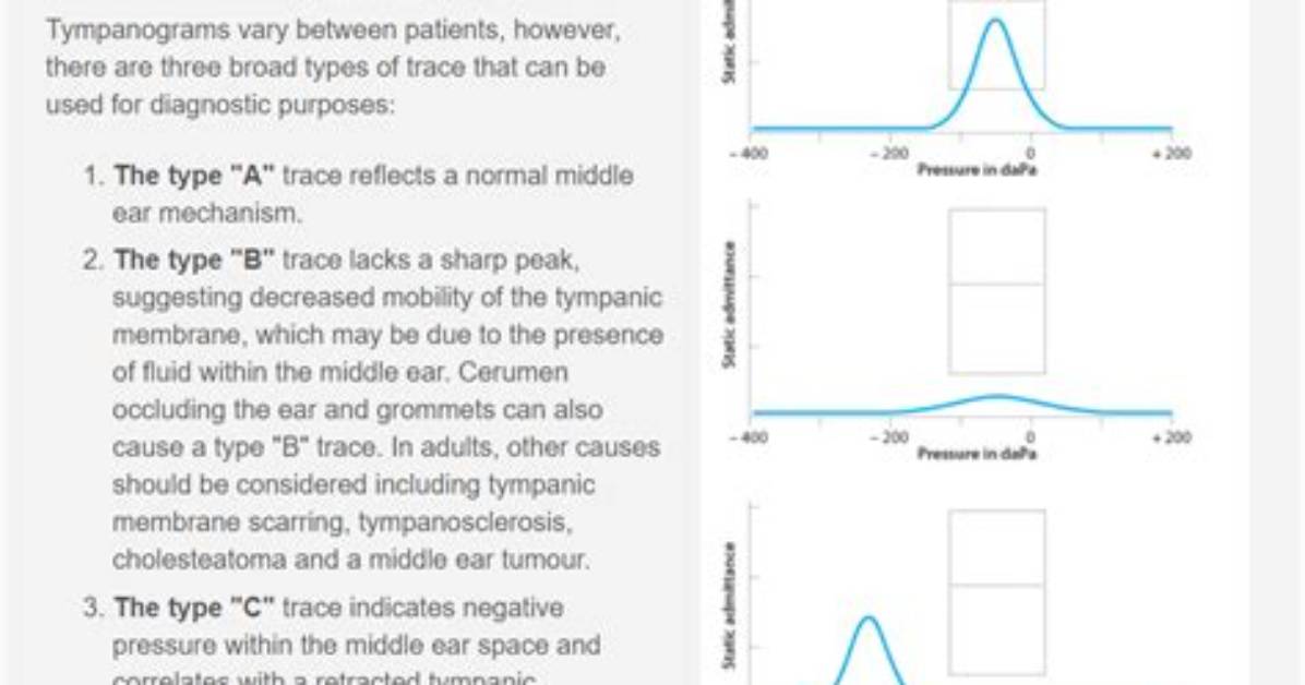 When to Do Tympanometry?
