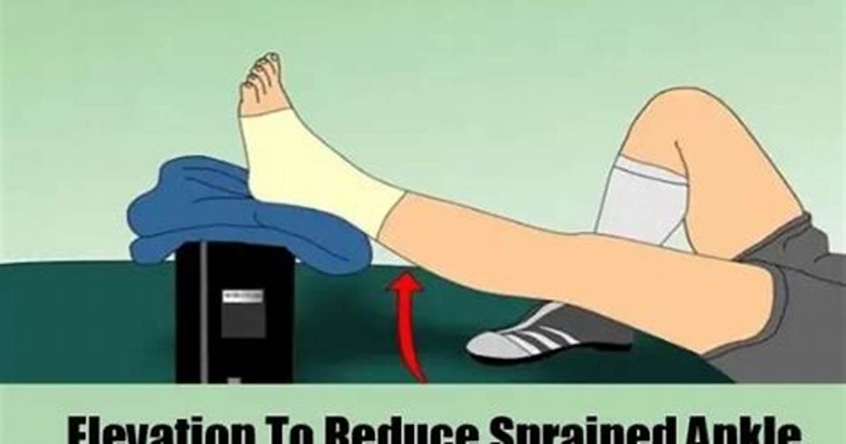 When to Stop Elevating Sprained Ankle?