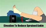 When to Stop Elevating Sprained Ankle?