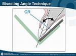 When to Use Bisecting Angle Technique?