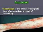 When to Use Excoriate?