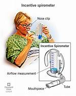 When to Use Incentive Spirometer?