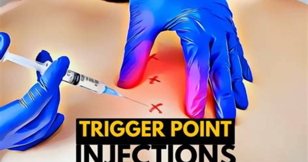 When Trigger Shot Is Given?