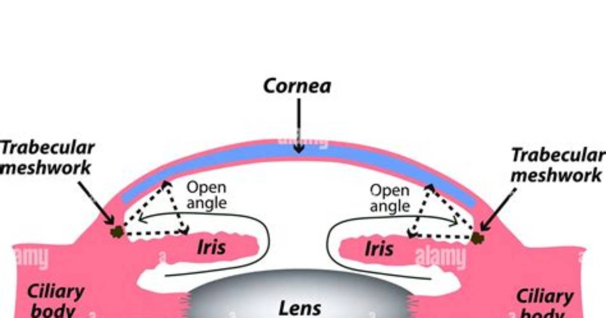 When Was Glaucoma Discovered?