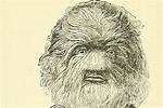 When Was Hypertrichosis First Discovered?