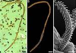 When Was Tapeworm Discovered
