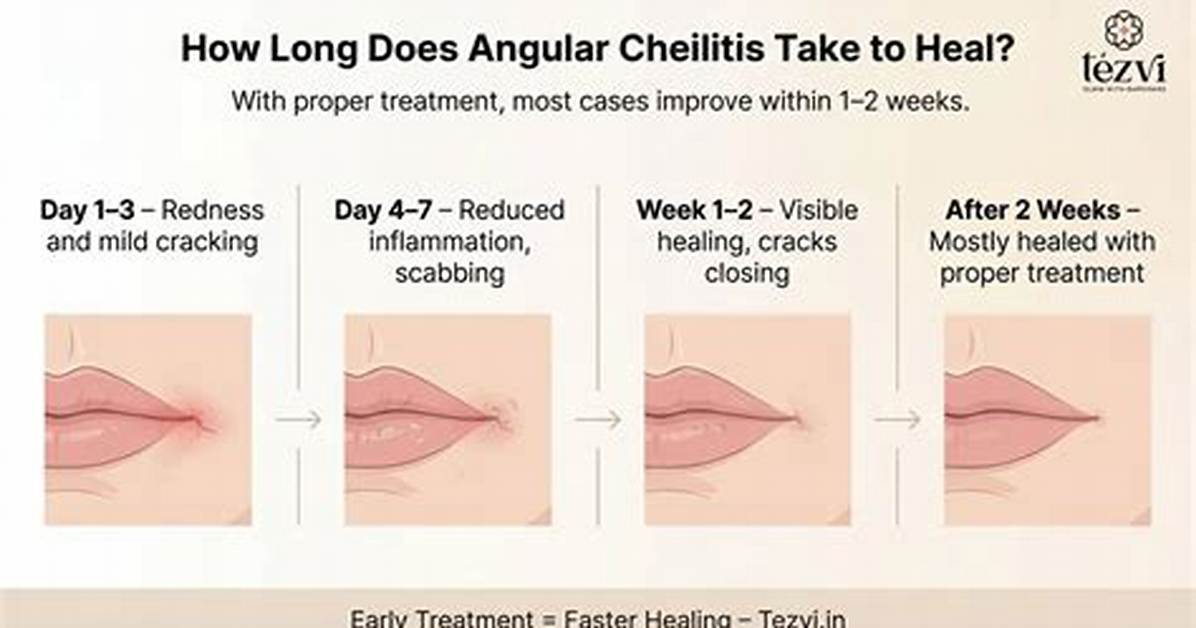 When Will Angular Cheilitis Heal?