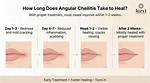 When Will Angular Cheilitis Heal?